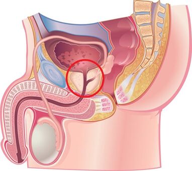 Место простаты мужчины